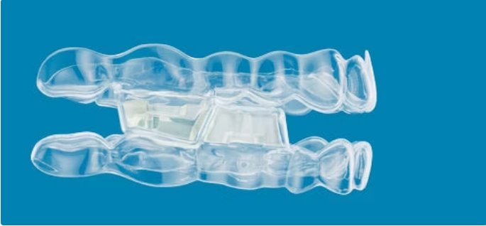 Invisalign Occlusal Blocks